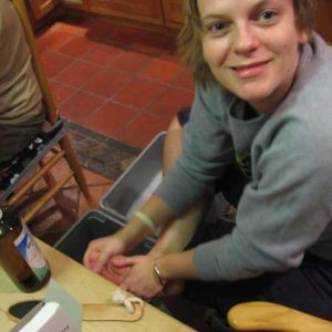 What Are Chilblains?