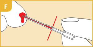 Coeliac Disease Test Kit