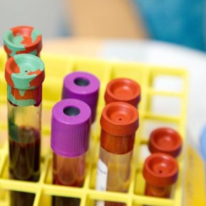 O Positive Blood Type