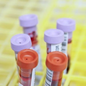 B Negative Blood Type