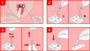 Strep A Test