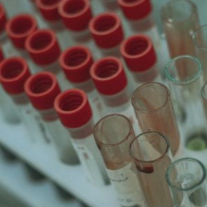 Blood Type Test Kit