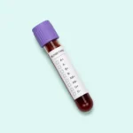 How Can I Find My Blood Type?
