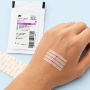 Wound Closure at Home: When to Use Steri-Strips